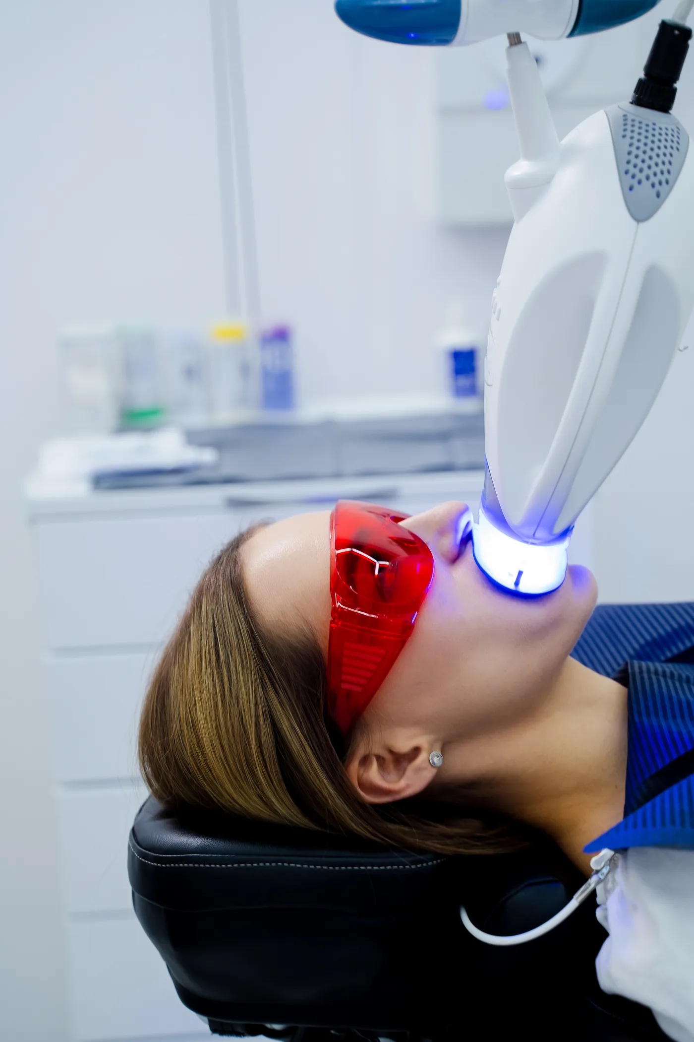 Clareamento dental em Passos-MG