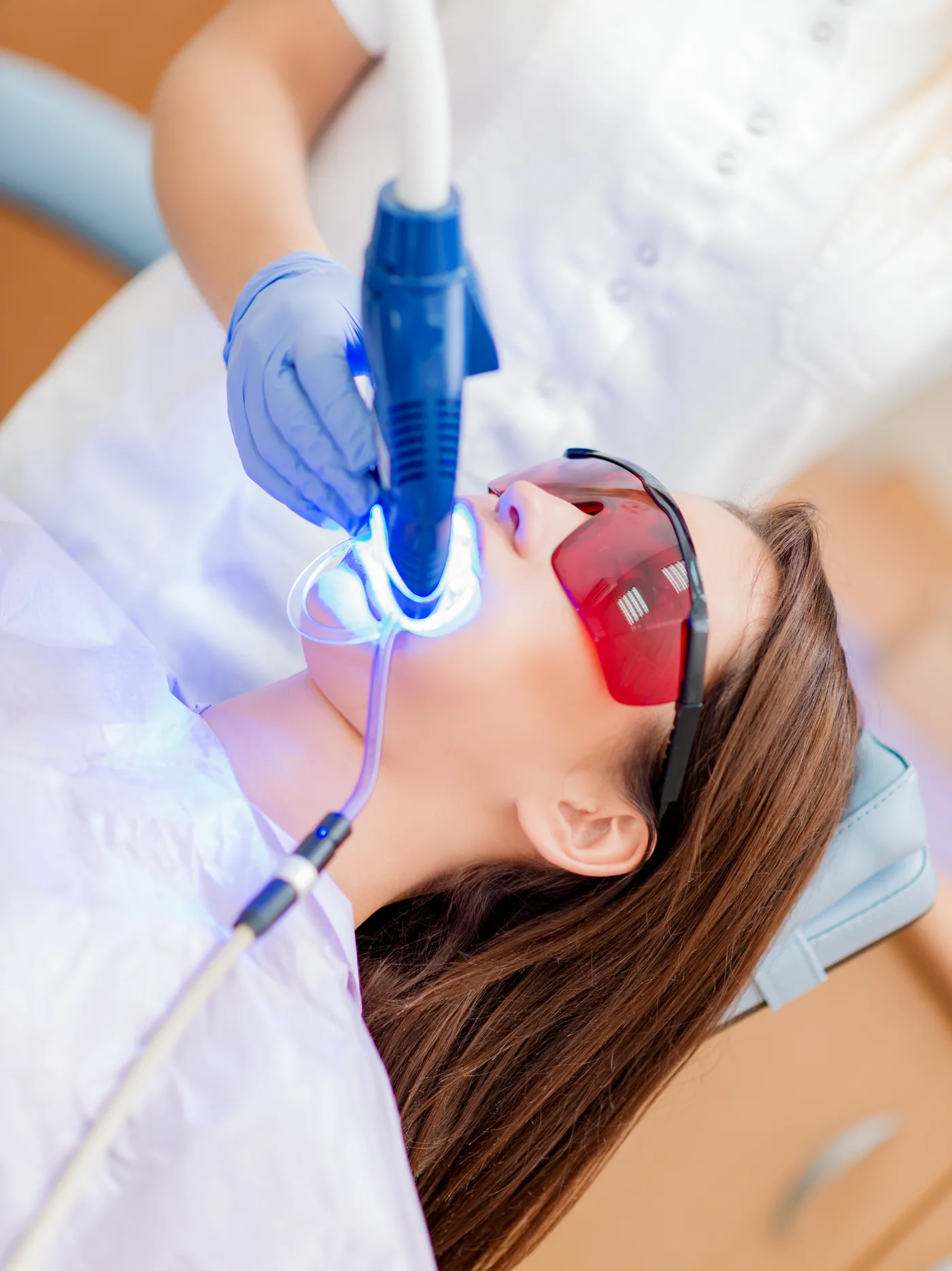 Limpeza profissional preparatória para clareamento dental