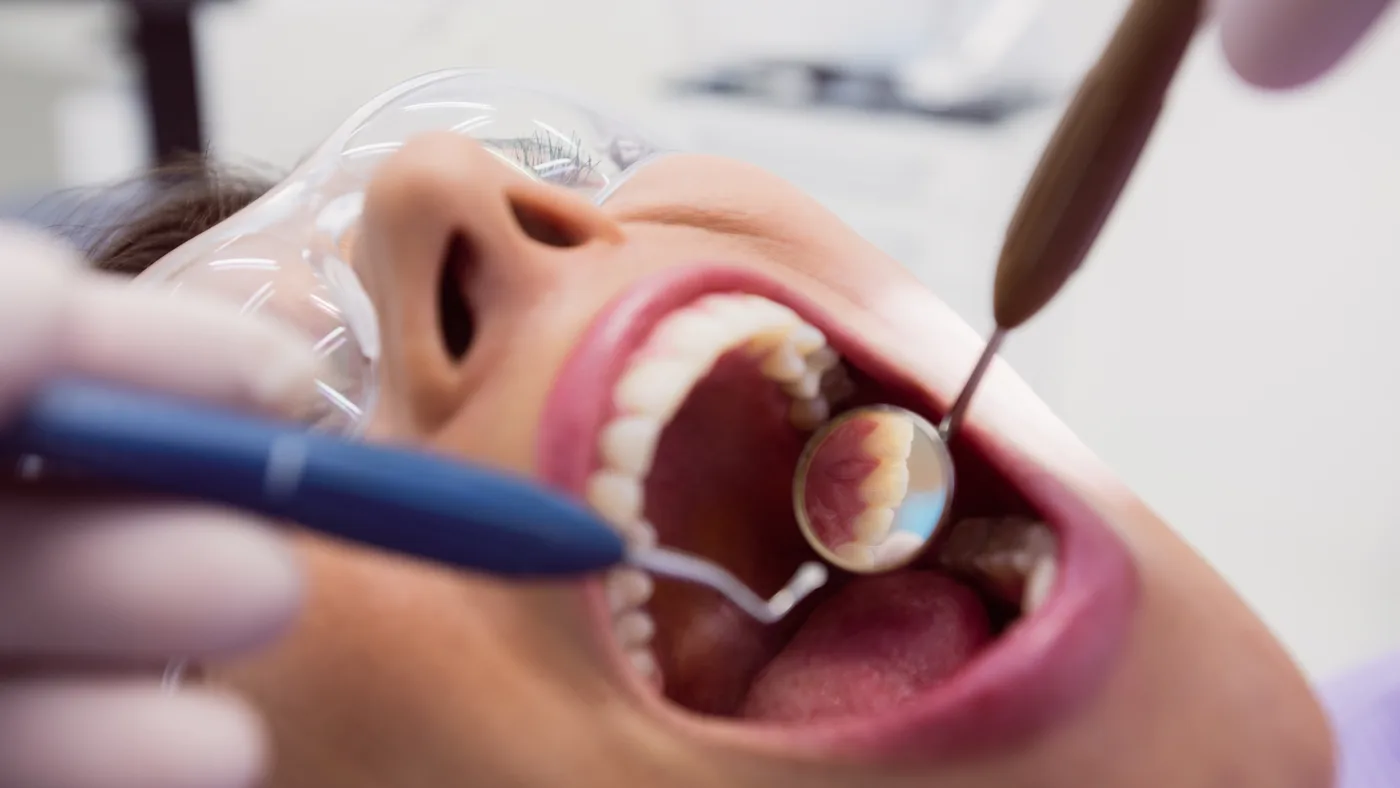 Procedimento odontológico para alívio da dor de dente em Passos-MG