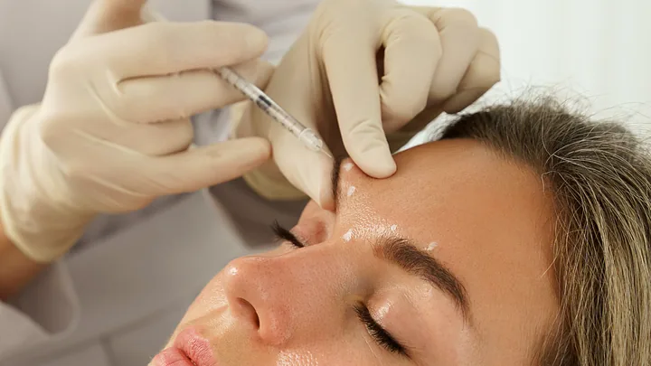 Imagem ilustrativa: profissional de luvas aplica toxina botulínica entre as sobrancelhas de uma paciente deitada