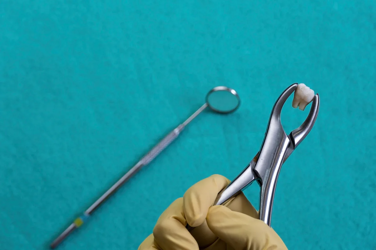 Planejamento de extração dentária em Passos-MG