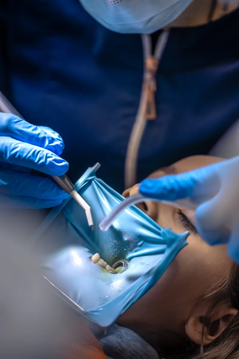 Extração de dente em Passos-MG com a Dra. Isabela Botelho