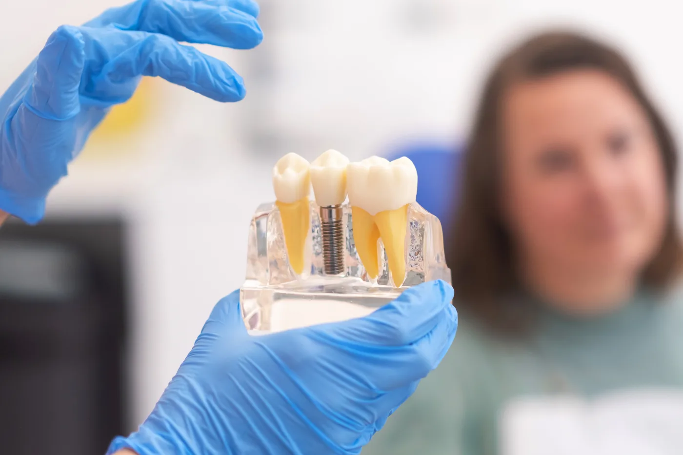 Modelo de implante dentário