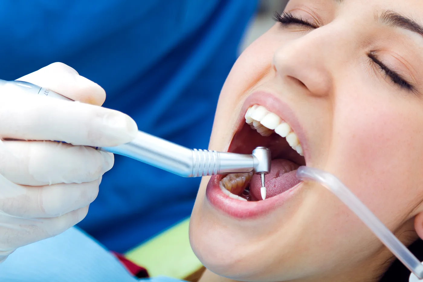 Avaliação odontológica antes da limpeza dental