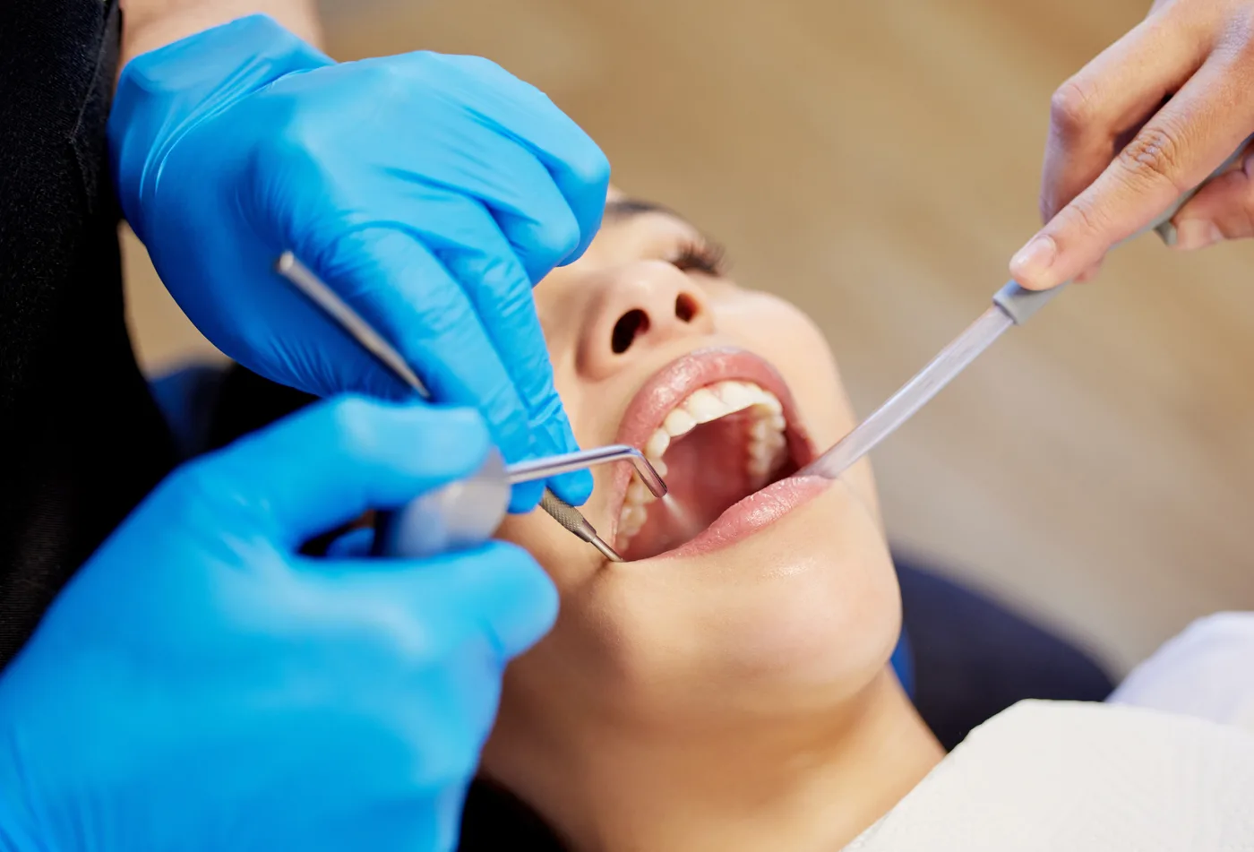 Sessão de limpeza dental profissional