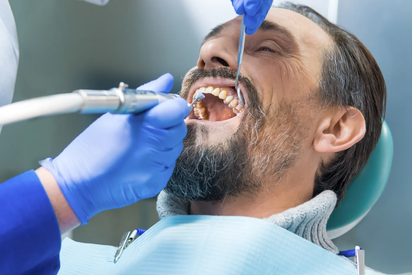 Polimento dental e remoção de manchas após raspagem