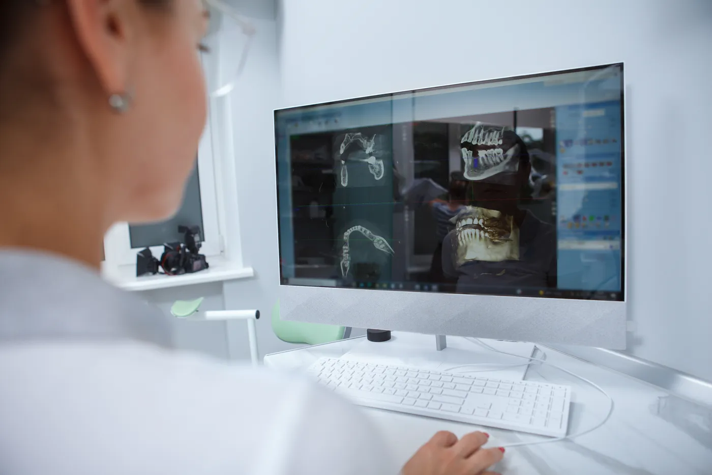 Análise de tomografia 3D em monitor para planejamento de prótese protocolo