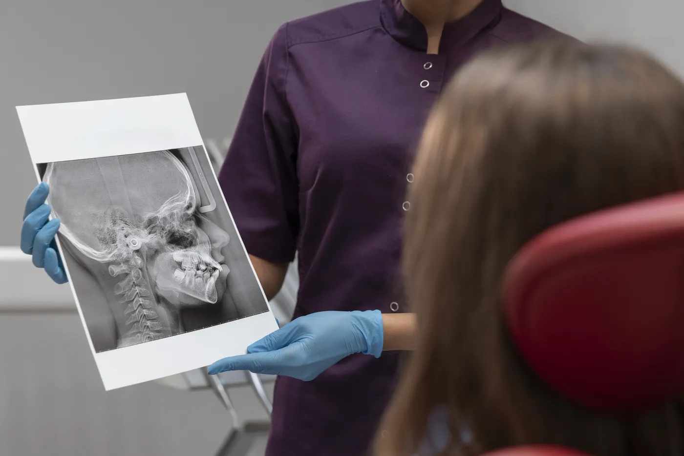 Análise de radiografia para acompanhar a osseointegração dos implantes