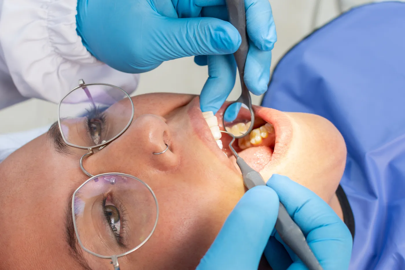 Restauração dentária em consultório